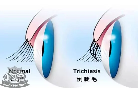 狗狗倒睫毛怎么處理 倒睫毛是會讓狗狗失明的