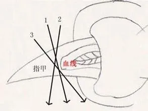 貴賓犬指甲修剪,怎么給泰迪剪指甲