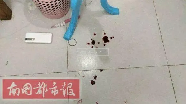 割腕自殺多久會死